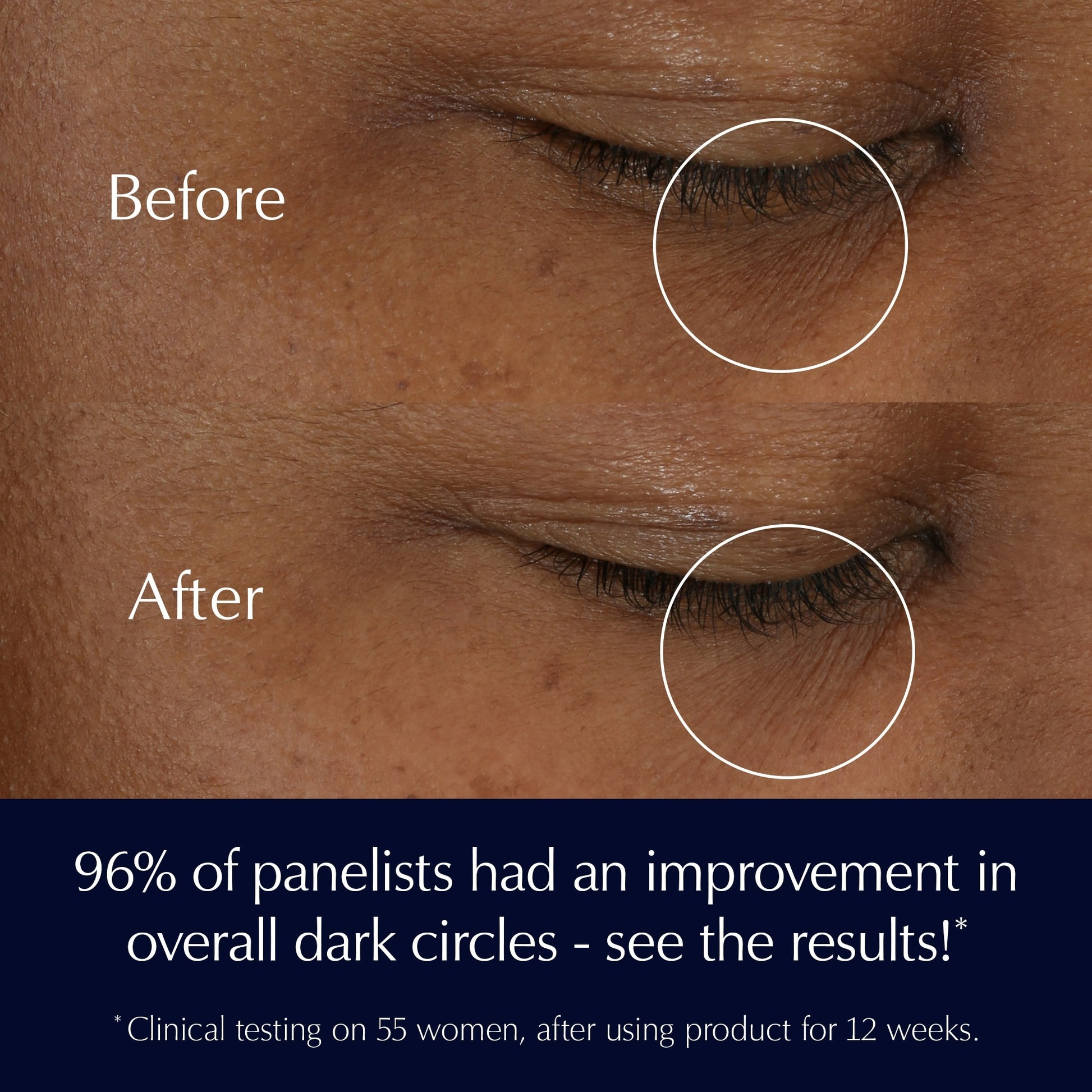 Advanced Night Repair Eye Cream Skincare Set Repair + Brighten + Hydrate