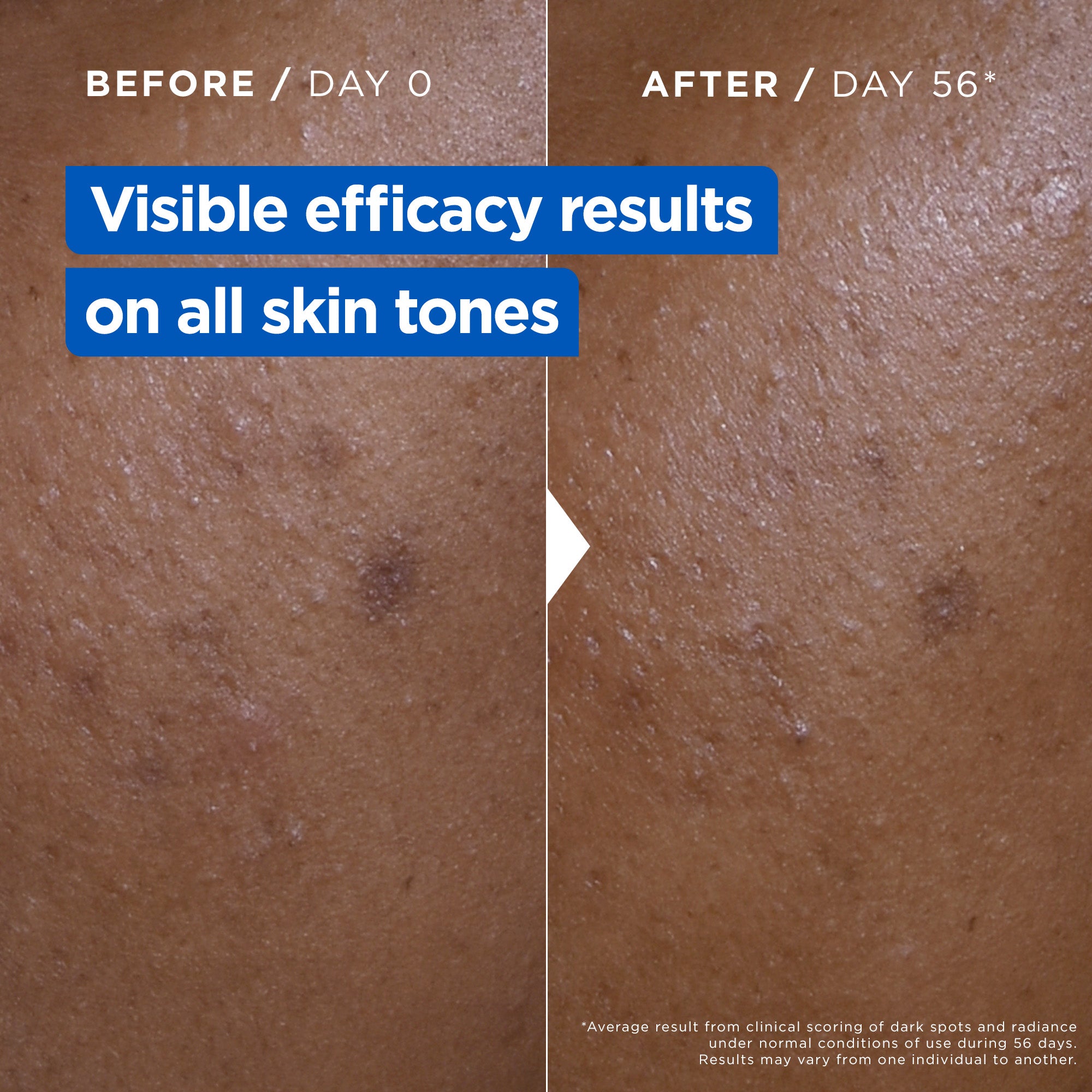 Niacinamide Bright Anti-Dark Spot Moisturizing Cream in a Jar for Dry and Uneven Skin -  400ml