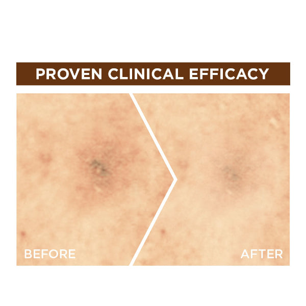 Fast Bright 10% Pure Vitamin C Brightening Overnight Serum - Before & After