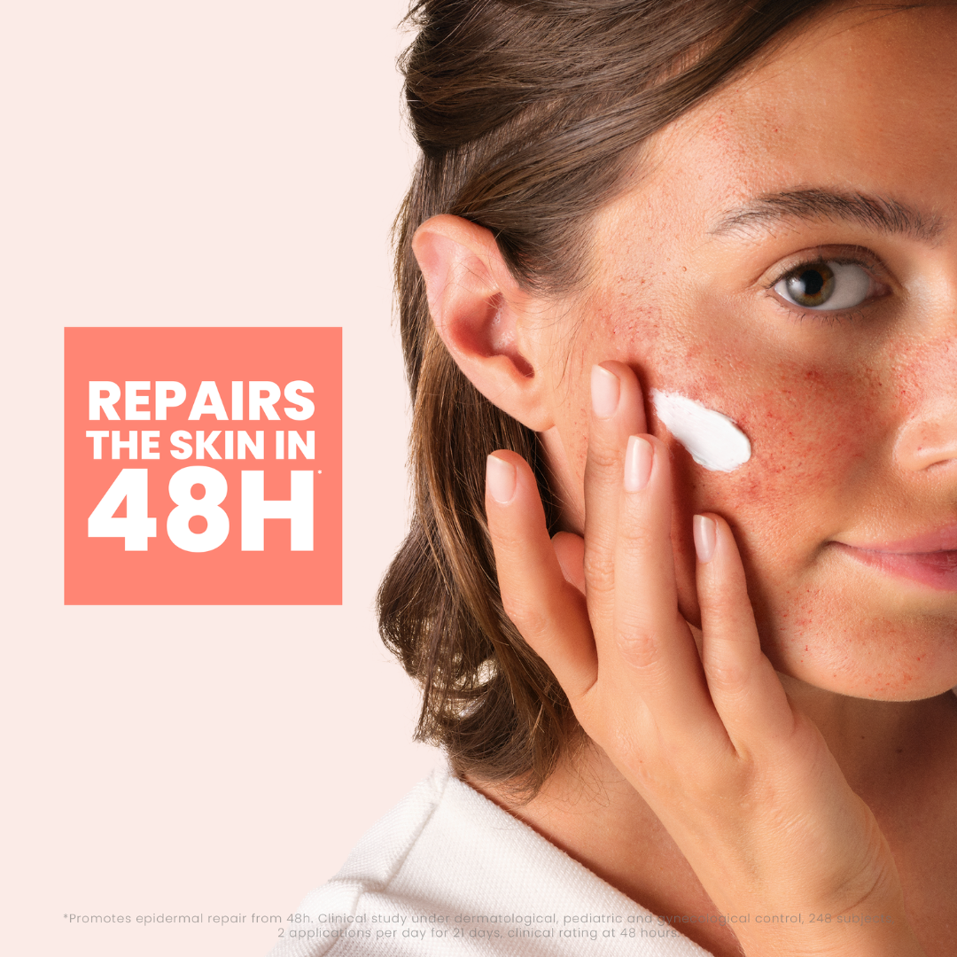 Cicalfate Instant Repairing Protective Cream For Damaged Skin