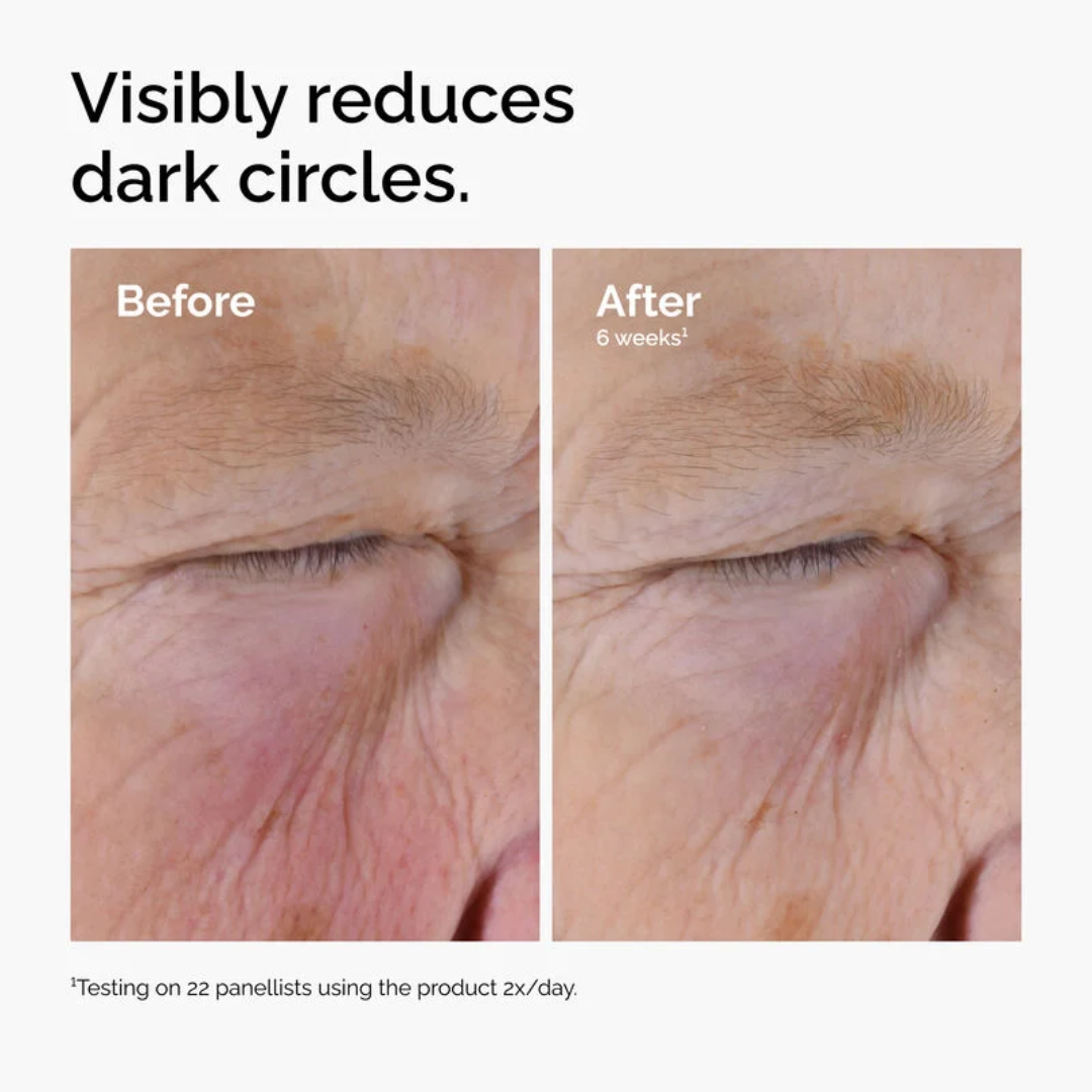 Caffeine Solution 5% + EGCG - Before & After