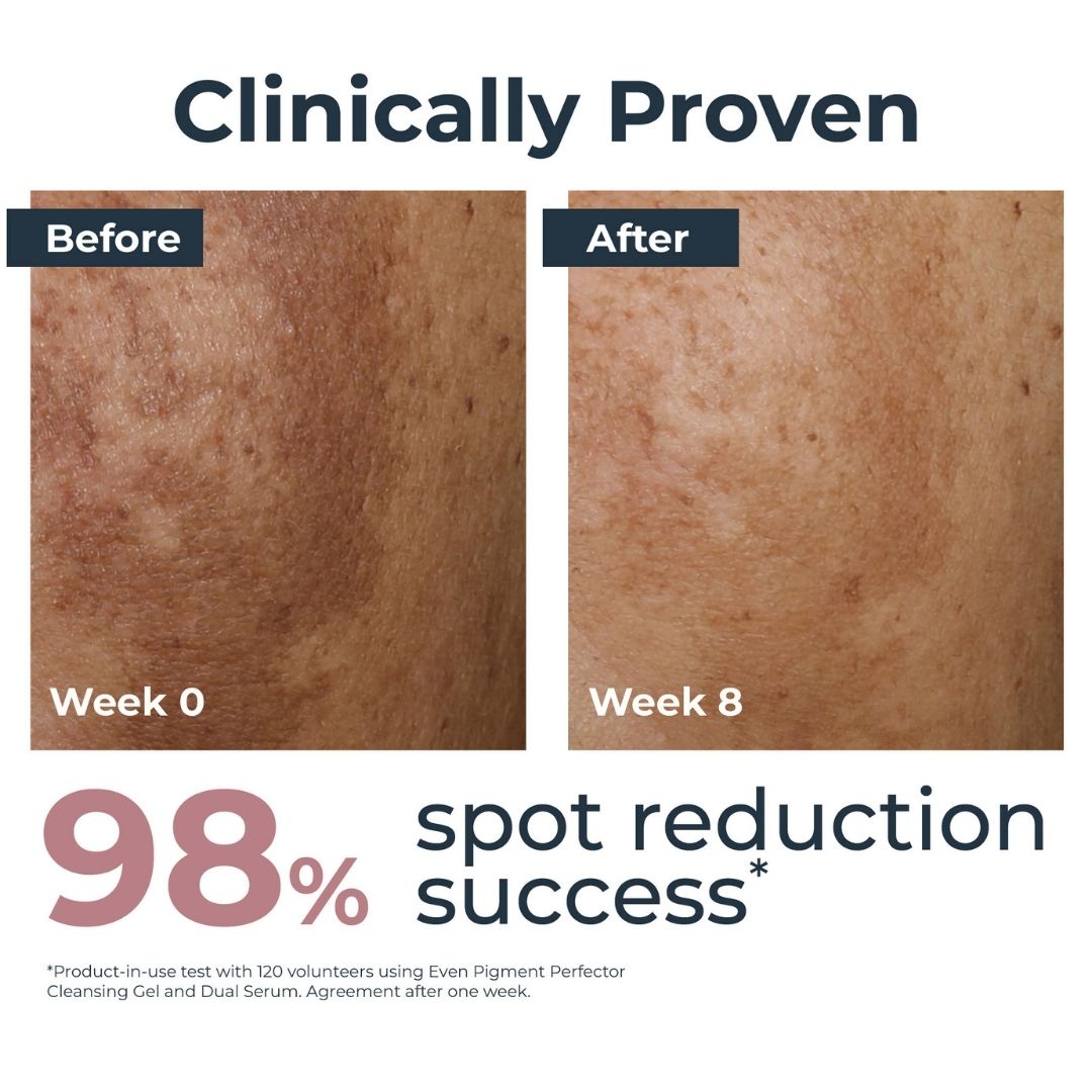 Eucerin Even Pigment Perfector Day Cream Spf 30  50  ML