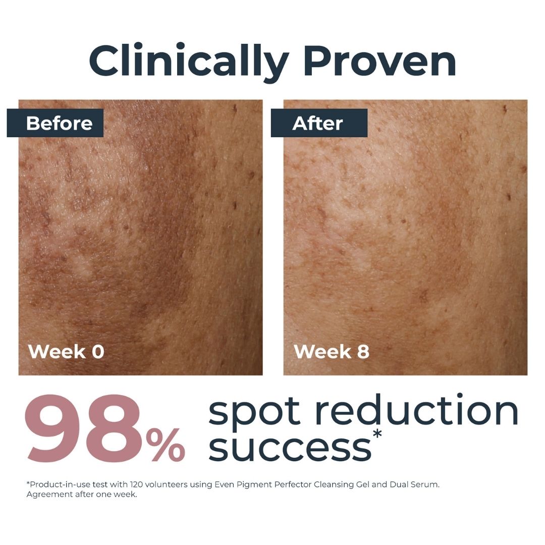 Eucerin Even Pigment Perfector Dual Serum  30 ML