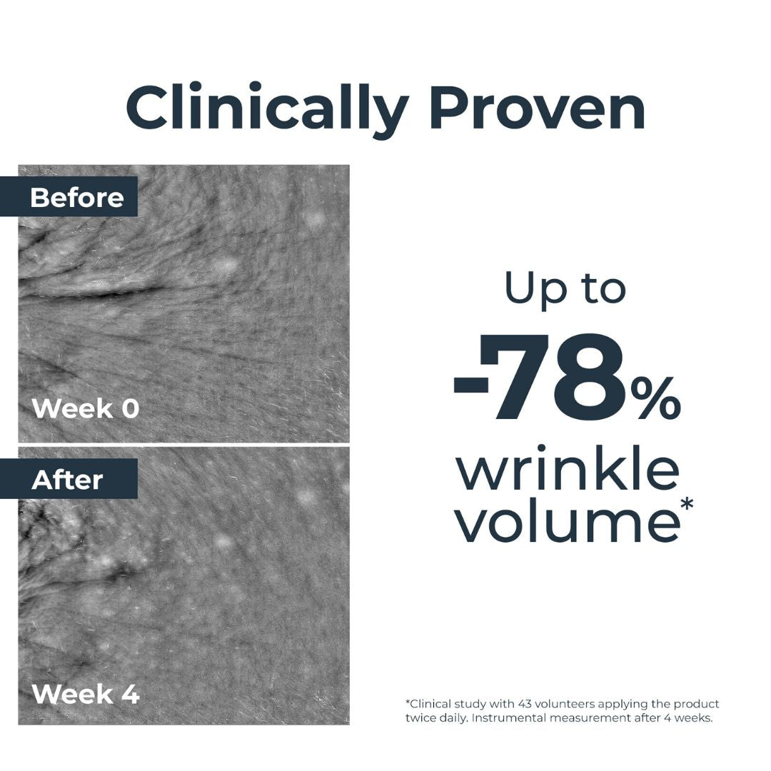 Eucerin Hyaluron-Filler Anti-Age Epicelline Face Serum, 30ml