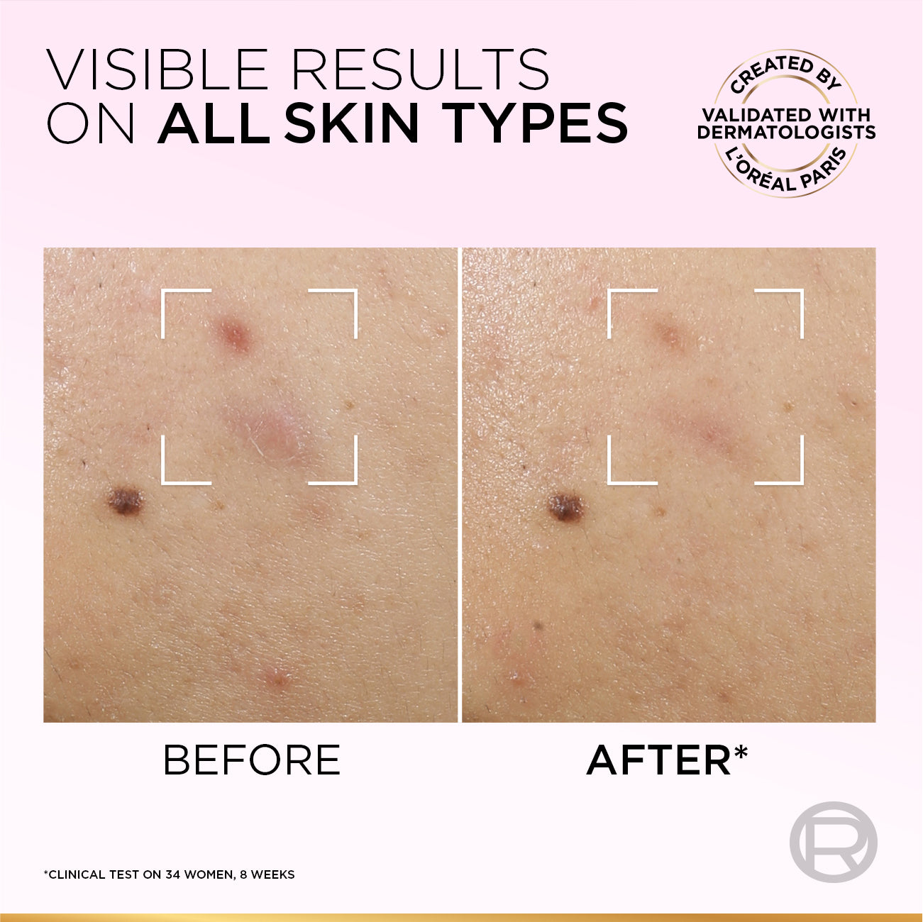 Glycolic-Bright Anti-Dark Spot Exfoliant Peel 15% AHA + BHA + PHA + Niacinamide 25ml.