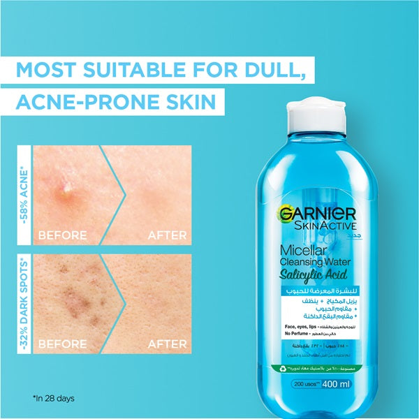 Garnier - Salicylic Acid Micellar Water Facial Anti-Acne Cleanser and Makeup Remover, for Oily and Acne-Pro