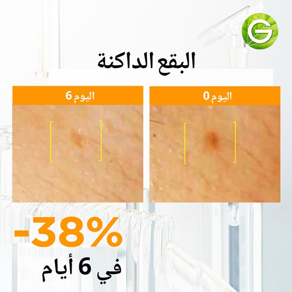 Garnier - Skin Active Fast Bright Hyperpigmentation Ampoule Serum Multipack (12 X 1.5ML)