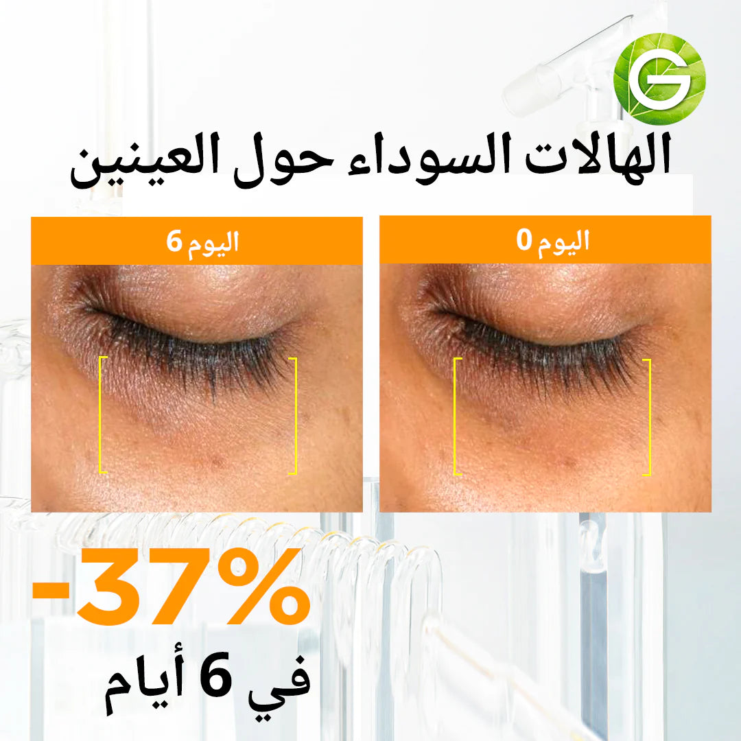 Garnier - Skin Active Fast Bright Hyperpigmentation Ampoule Serum Multipack (12 X 1.5ML)
