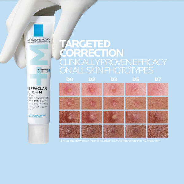 La Roche-Posay Effaclar Duo+M Acne Treatment Cream for Oily and Acne Prone Skin