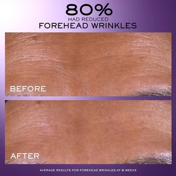 Rénergie C.R.x. Triple Serum Retinol - Before & After