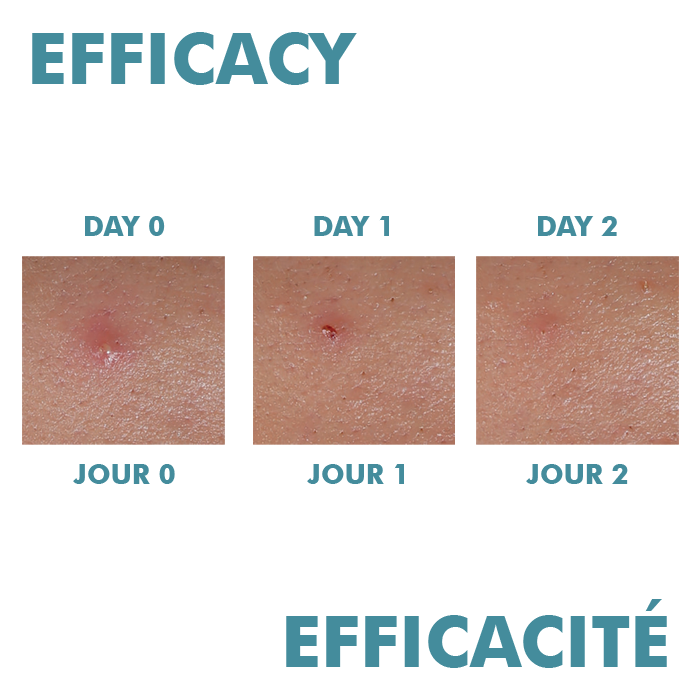 Comedomed Peeling Intensive Breakouts Cream